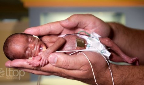 В турецкой клинике выходили ребенка, родившегося с весом 285 граммов
