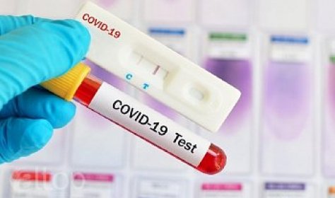 Турция разработала тест на антитела к Covid-19